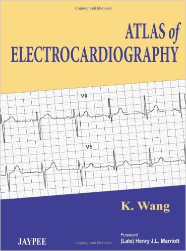 free-pdf-download-Atlas of Electrocardiography 1st Edition