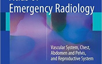 free-pdf-download-Atlas of Emergency Radiology: Vascular System