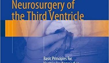 free-pdf-download-Atlas of Endoscopic Neurosurgery of the Third Ventricle 1st ed. 2017 Edition