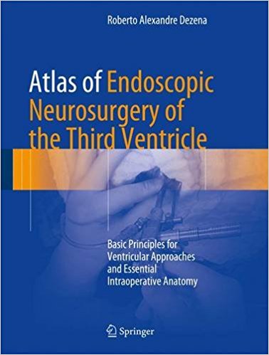 free-pdf-download-Atlas of Endoscopic Neurosurgery of the Third Ventricle 1st ed. 2017 Edition