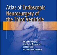 free-pdf-download-Atlas of Endoscopic Neurosurgery of the Third Ventricle: Basic Principles for Ventricular Approaches and Essential Intraoperative Anatomy 1st ed. 2017 Edition