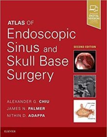 free-pdf-download-Atlas of Endoscopic Sinus and Skull Base Surgery 2nd Edition