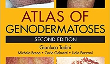 free-pdf-download-Atlas of Genodermatoses