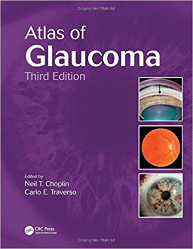 free-pdf-download-Atlas of Glaucoma