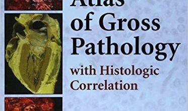 free-pdf-download-Atlas of Gross Pathology: With Histologic Correlation 1st Edition