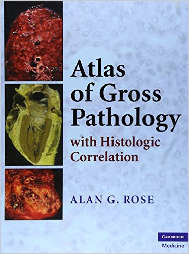 free-pdf-download-Atlas of Gross Pathology: With Histologic Correlation 1st Edition