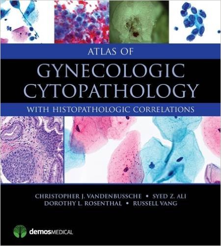 free-pdf-download-Atlas of Gynecologic Cytopathology: with Histopathologic Correlations 1st Edition