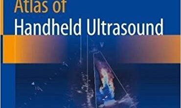 free-pdf-download-Atlas of Handheld Ultrasound 1st ed