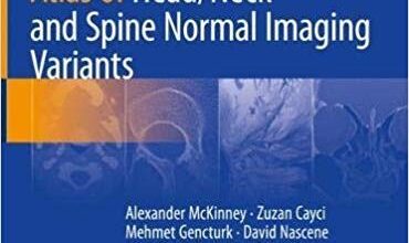 free-pdf-download-Atlas of Head/Neck and Spine Normal Imaging Variants 1st ed