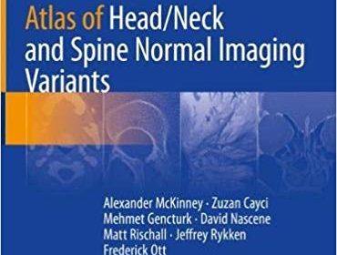 free-pdf-download-Atlas of Head/Neck and Spine Normal Imaging Variants 1st ed