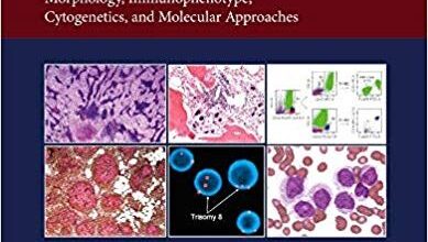 free-pdf-download-Atlas of Hematopathology: Morphology