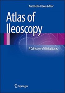 free-pdf-download-Atlas of Ileoscopy: A Collection of Clinical Cases