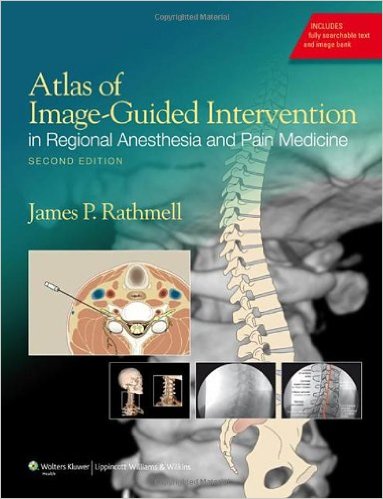 free-pdf-download-Atlas of Image-Guided Intervention in Regional Anesthesia and Pain Medicine Second Edition