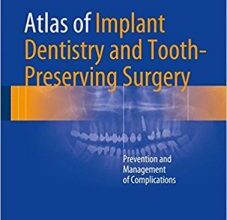 free-pdf-download-Atlas of Implant Dentistry and Tooth-Preserving Surgery: Prevention and Management of Complications 1st ed. 2017 Edition