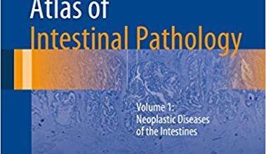 free-pdf-download-Atlas of Intestinal Pathology: Volume 1: Neoplastic Diseases of the Intestines