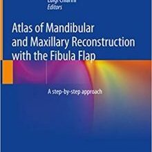 free-pdf-download-Atlas of Mandibular and Maxillary Reconstruction with the Fibula Flap: A step-by-step approach