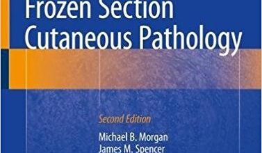 free-pdf-download-Atlas of Mohs and Frozen Section Cutaneous Pathology 2nd ed