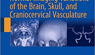 free-pdf-download-Atlas of Normal Imaging Variations of the Brain