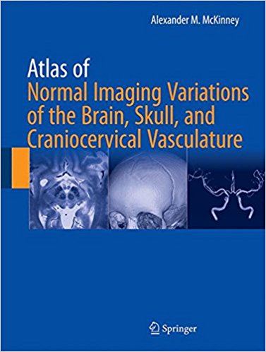 free-pdf-download-Atlas of Normal Imaging Variations of the Brain