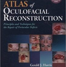 free-pdf-download-Atlas of Oculofacial Reconstruction: Principles and Techniques for the Repair of Periocular Defects 1 Har/Psc Edition