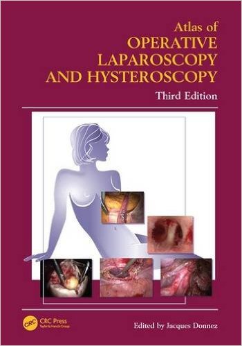 free-pdf-download-Atlas of Operative Laparoscopy and Hysteroscopy