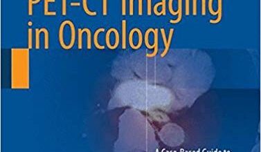 free-pdf-download-Atlas of PET-CT Imaging in Oncology: A Case-Based Guide to Image Interpretation