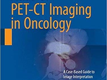 free-pdf-download-Atlas of PET-CT Imaging in Oncology: A Case-Based Guide to Image Interpretation