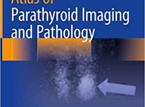 free-pdf-download-Atlas of Parathyroid Imaging and Pathology