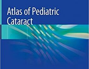 free-pdf-download-Atlas of Pediatric Cataract