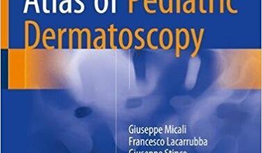 free-pdf-download-Atlas of Pediatric Dermatoscopy 1st ed