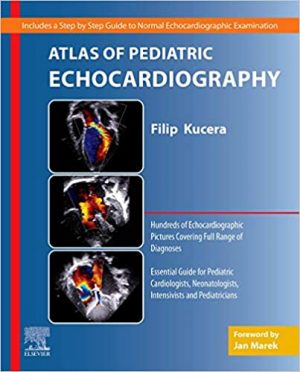 free-pdf-download-Atlas of Pediatric Echocardiography