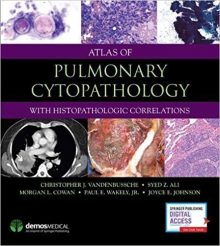 free-pdf-download-Atlas of Pulmonary Cytopathology