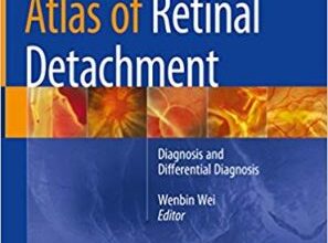 free-pdf-download-Atlas of Retinal Detachment: Diagnosis and Differential Diagnosis