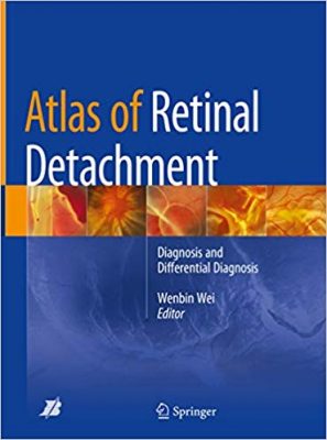 free-pdf-download-Atlas of Retinal Detachment: Diagnosis and Differential Diagnosis