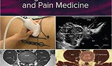 free-pdf-download-Atlas of Sonoanatomy for Regional Anesthesia and Pain Medicine 1st Edition