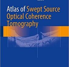 free-pdf-download-Atlas of Swept Source Optical Coherence Tomography 1st ed. 2017 Edition