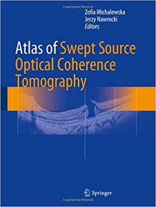 free-pdf-download-Atlas of Swept Source Optical Coherence Tomography 1st ed. 2017 Edition