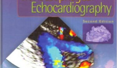 free-pdf-download-Atlas of Transesophageal Echocardiography Second Edition