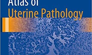 free-pdf-download-Atlas of Uterine Pathology (Atlas of Anatomic Pathology)