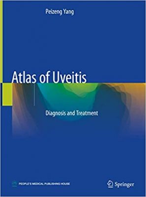 free-pdf-download-Atlas of Uveitis: Diagnosis and Treatment