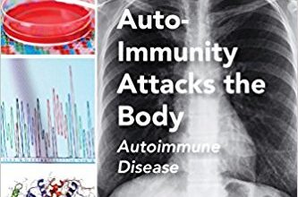 free-pdf-download-Auto-Immunity Attacks the Body: Autoimmune Disease