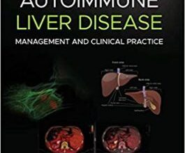 free-pdf-download-Autoimmune Liver Disease: Management and Clinical Practice