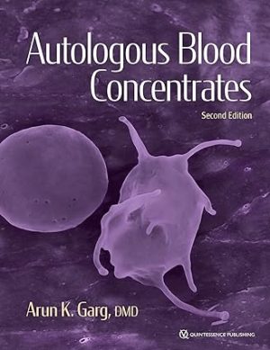 free-pdf-download-Autologous Blood Concentrates