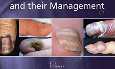 free-pdf-download-Baran and Dawber’s Diseases of the Nails and their Management 4th Edition