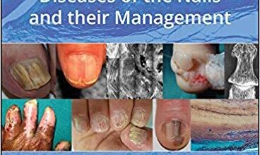 free-pdf-download-Baran and Dawber’s Diseases of the Nails and their Management 5th Edition