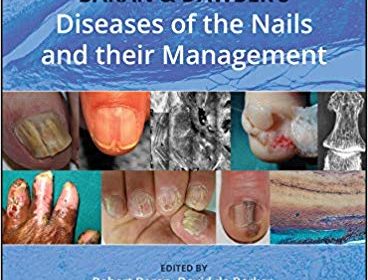 free-pdf-download-Baran and Dawber’s Diseases of the Nails and their Management 5th Edition