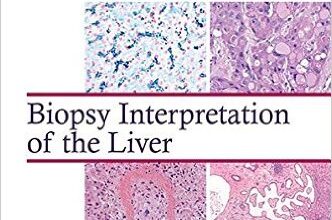 free-pdf-download-Biopsy Interpretation of the Liver (Biopsy Interpretation Series)