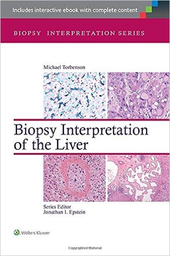 free-pdf-download-Biopsy Interpretation of the Liver (Biopsy Interpretation Series)