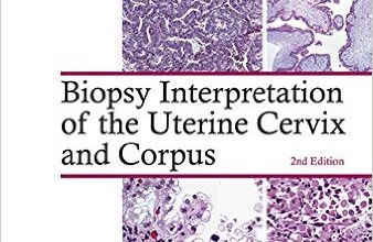 free-pdf-download-Biopsy Interpretation of the Uterine Cervix and Corpus (Biopsy Interpretation Series) 2nd Edition