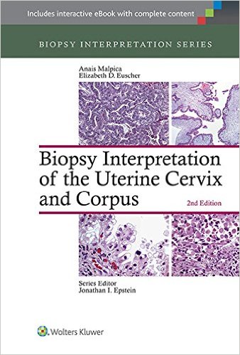 free-pdf-download-Biopsy Interpretation of the Uterine Cervix and Corpus (Biopsy Interpretation Series) 2nd Edition